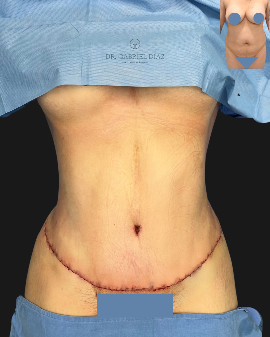 Gabriel Diaz Rosas-0