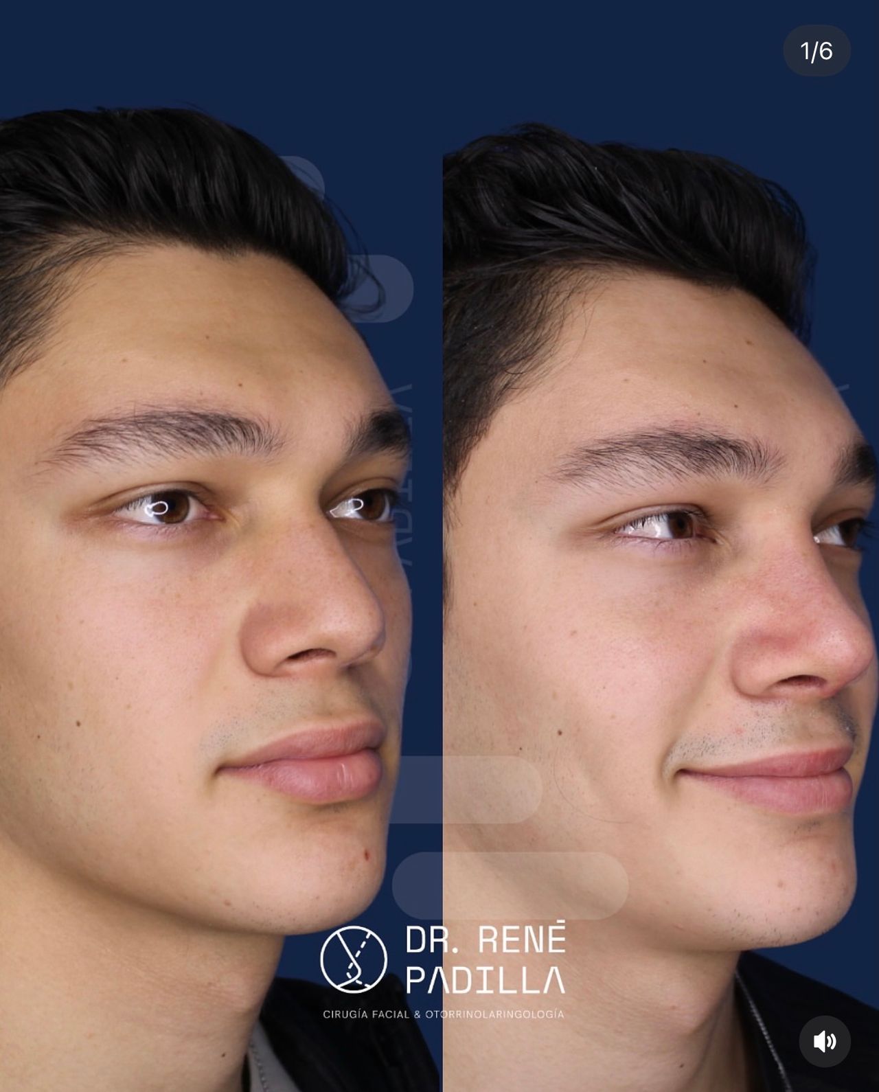 René Emmanuel Padilla López-11