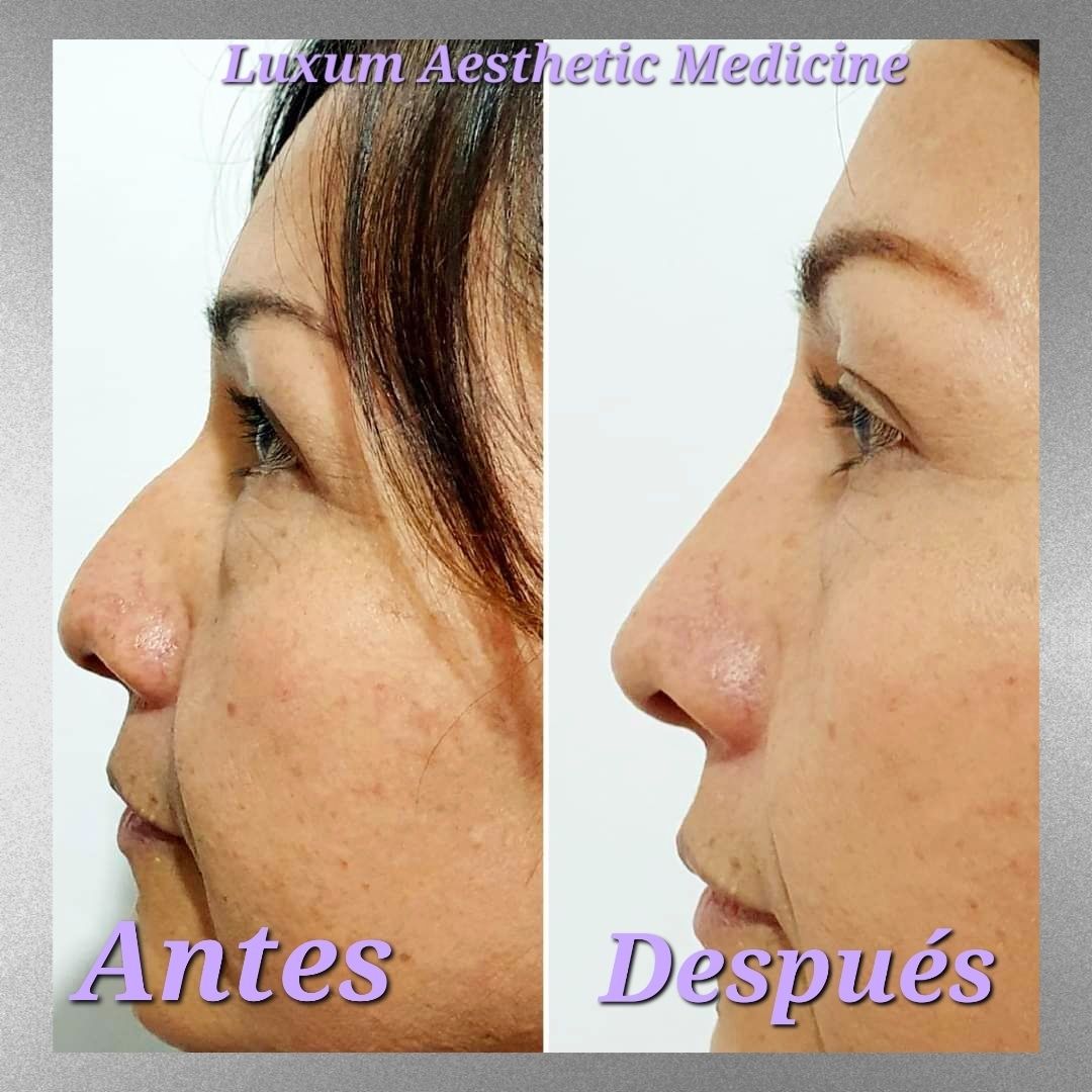 Edgar Gómez García-40