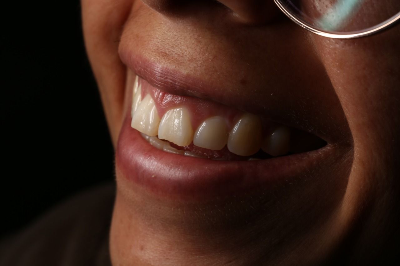 Oscar Alejandro Azcárate Tendilla-11