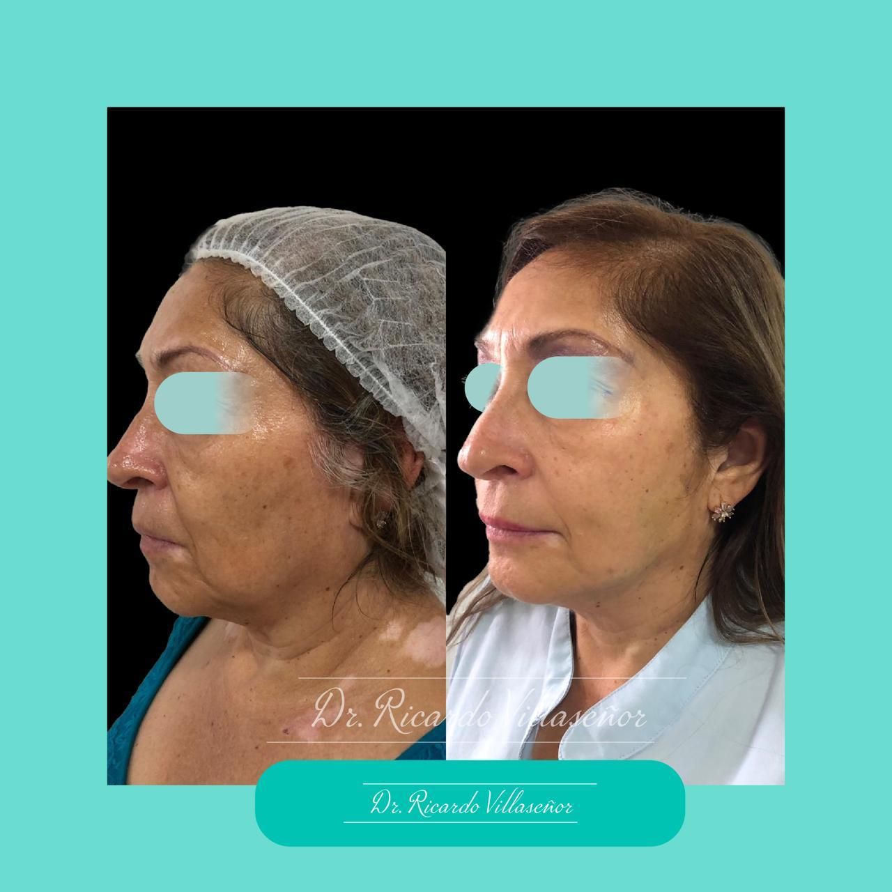 Ricardo Villaseñor Dominguez-0