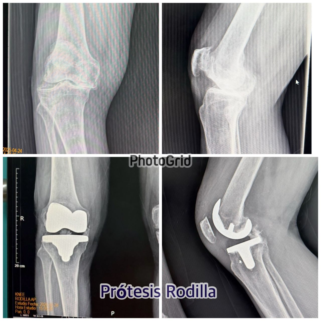 Carlos Tapia Hernández-16