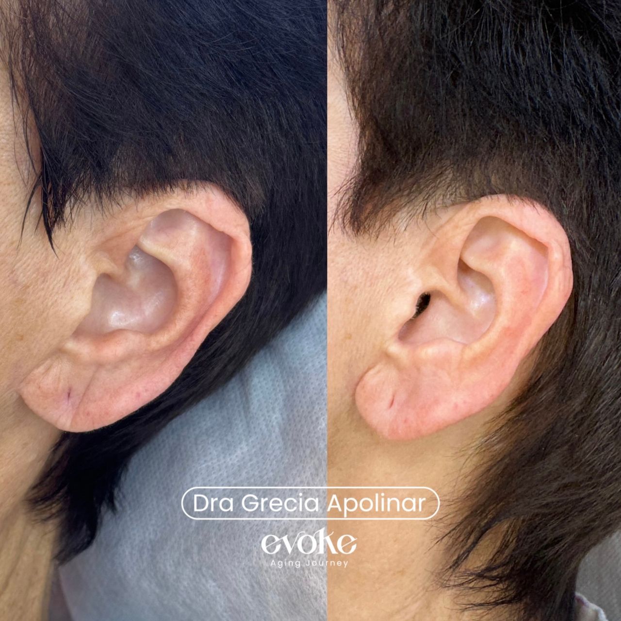 Grecia Apolinar Moreno-1