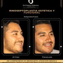 Enrique Serrano Cruz-24
