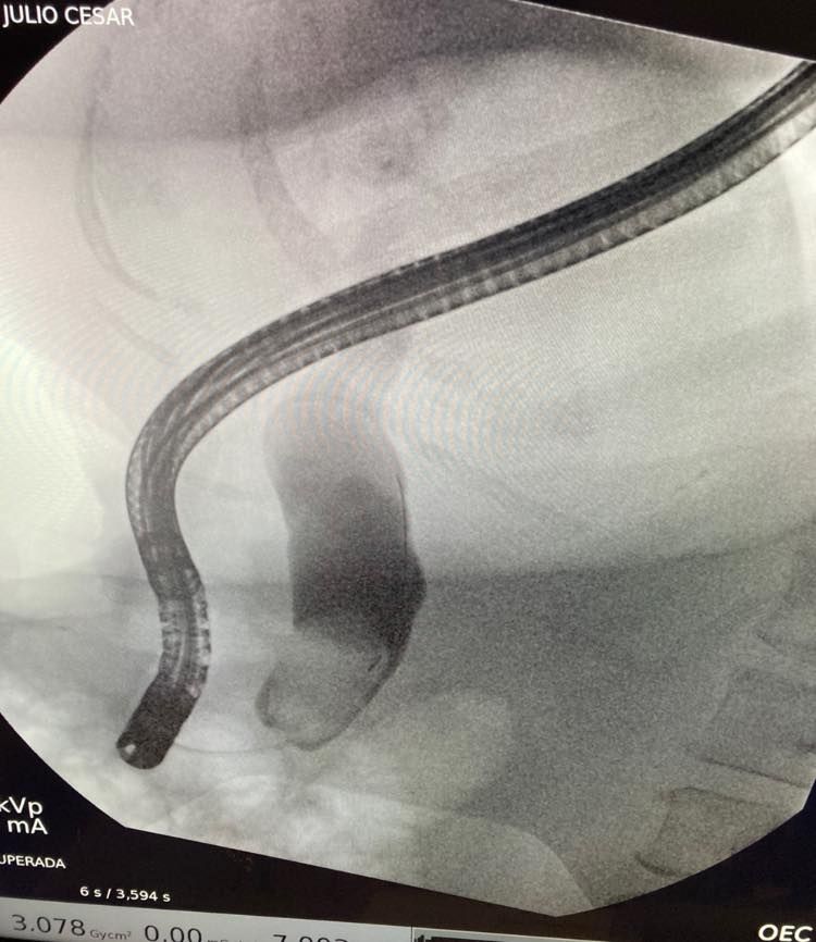 J. César Reyes Vásquez-1