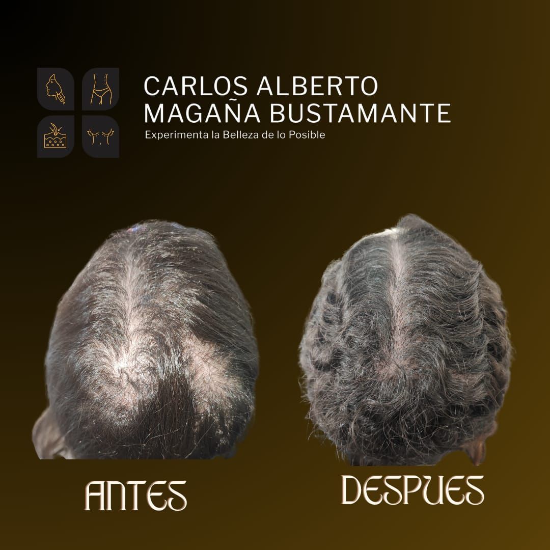 Carlos Alberto Magaña Bustamante-17