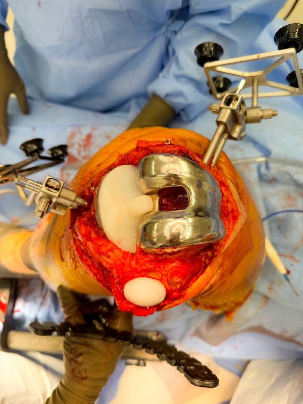 Jhon Jairo Galvis Bermudez-43