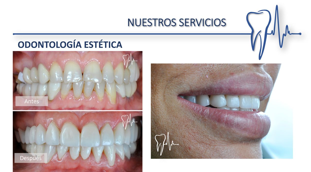 Alberto Companioni Bacha-19