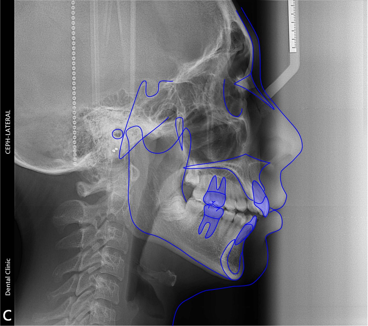 Adriana Ramos Carrillo-15