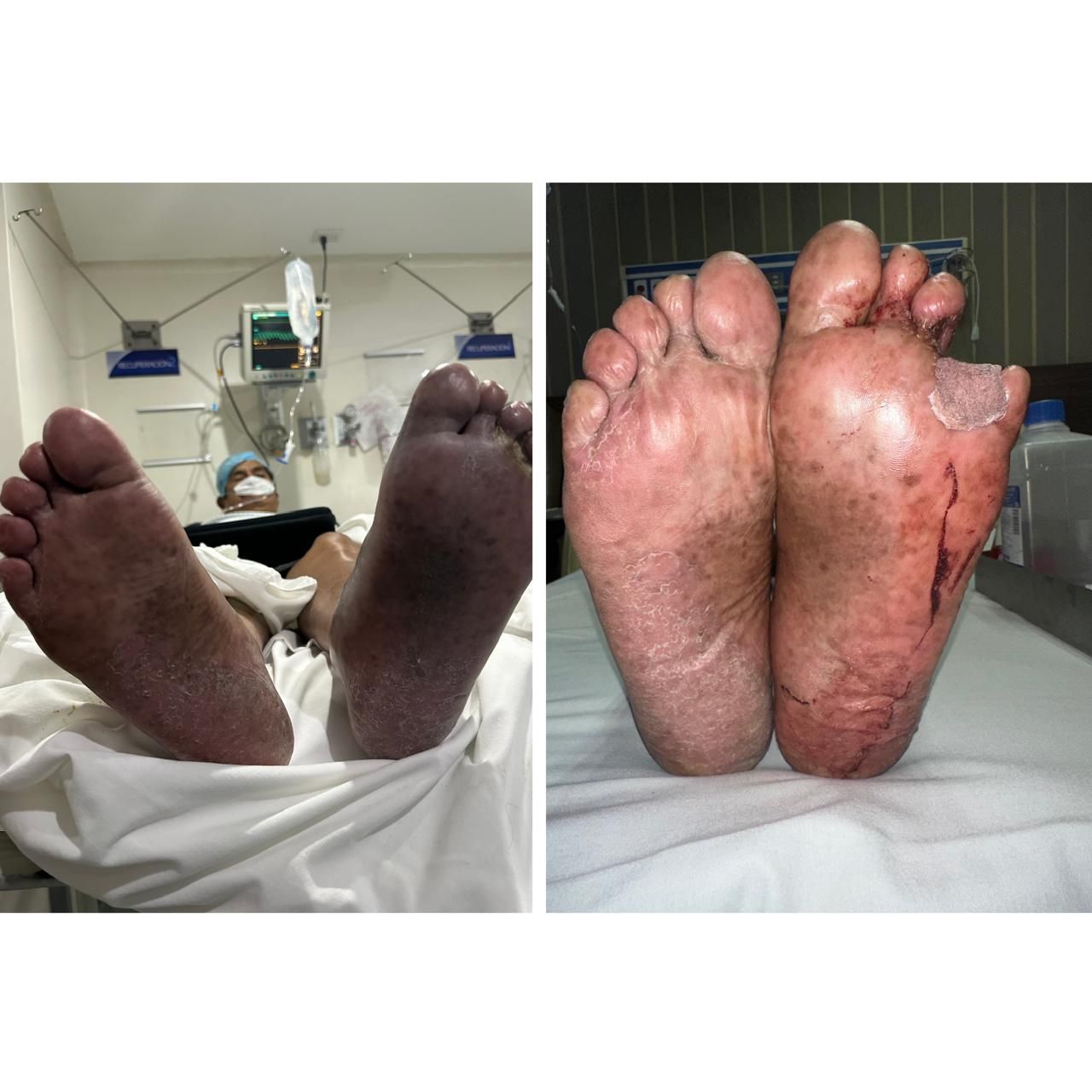 Jhonatan López González-59