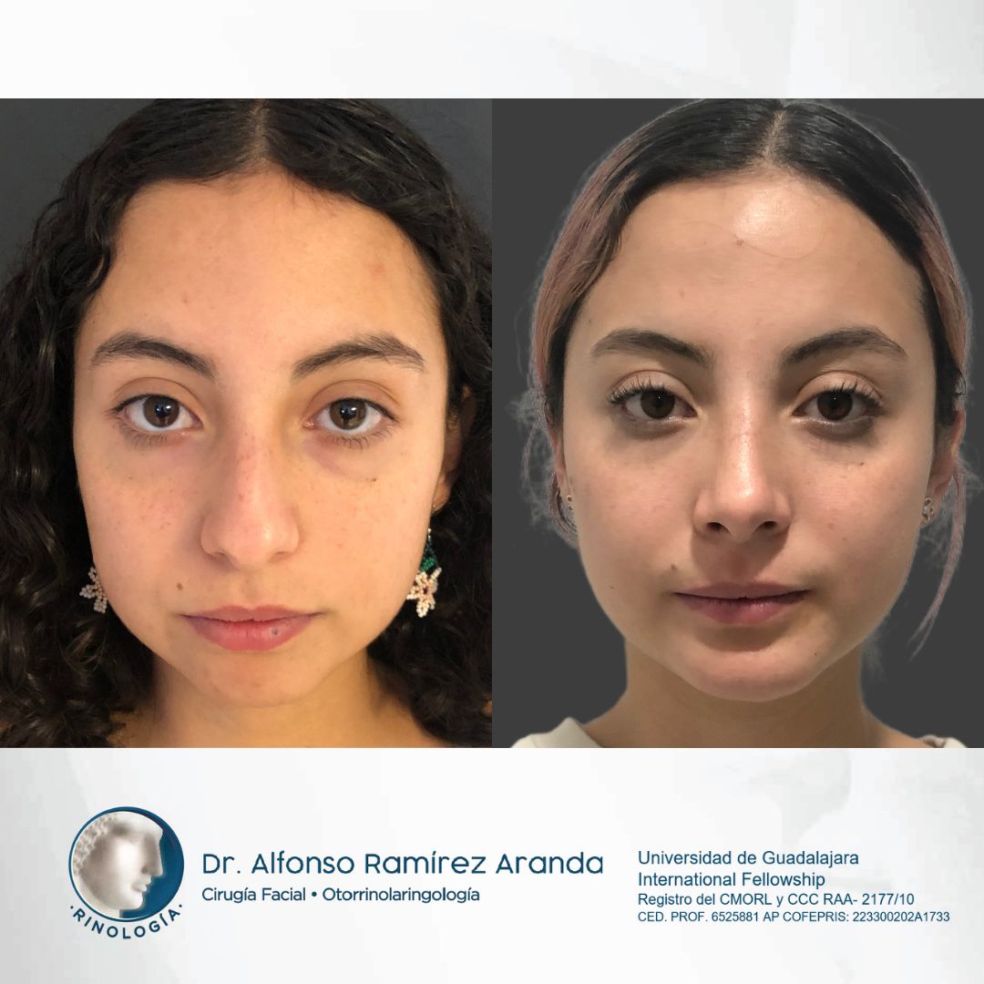 Alfonso Ramírez Aranda-11