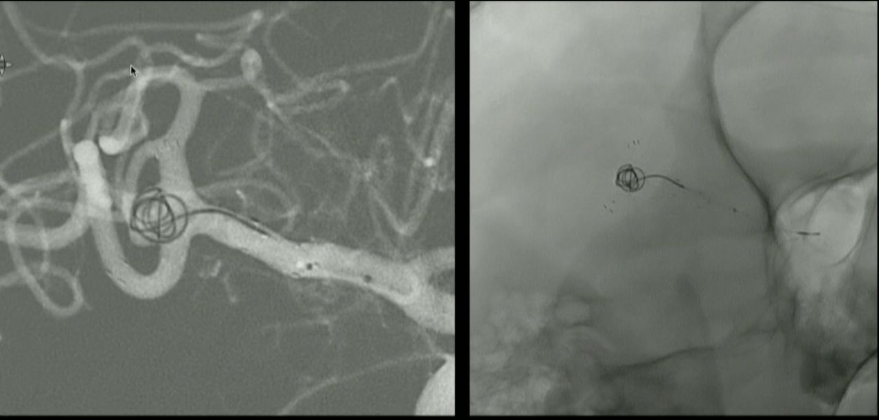 Hilario Paul Alanis Resendiz-3