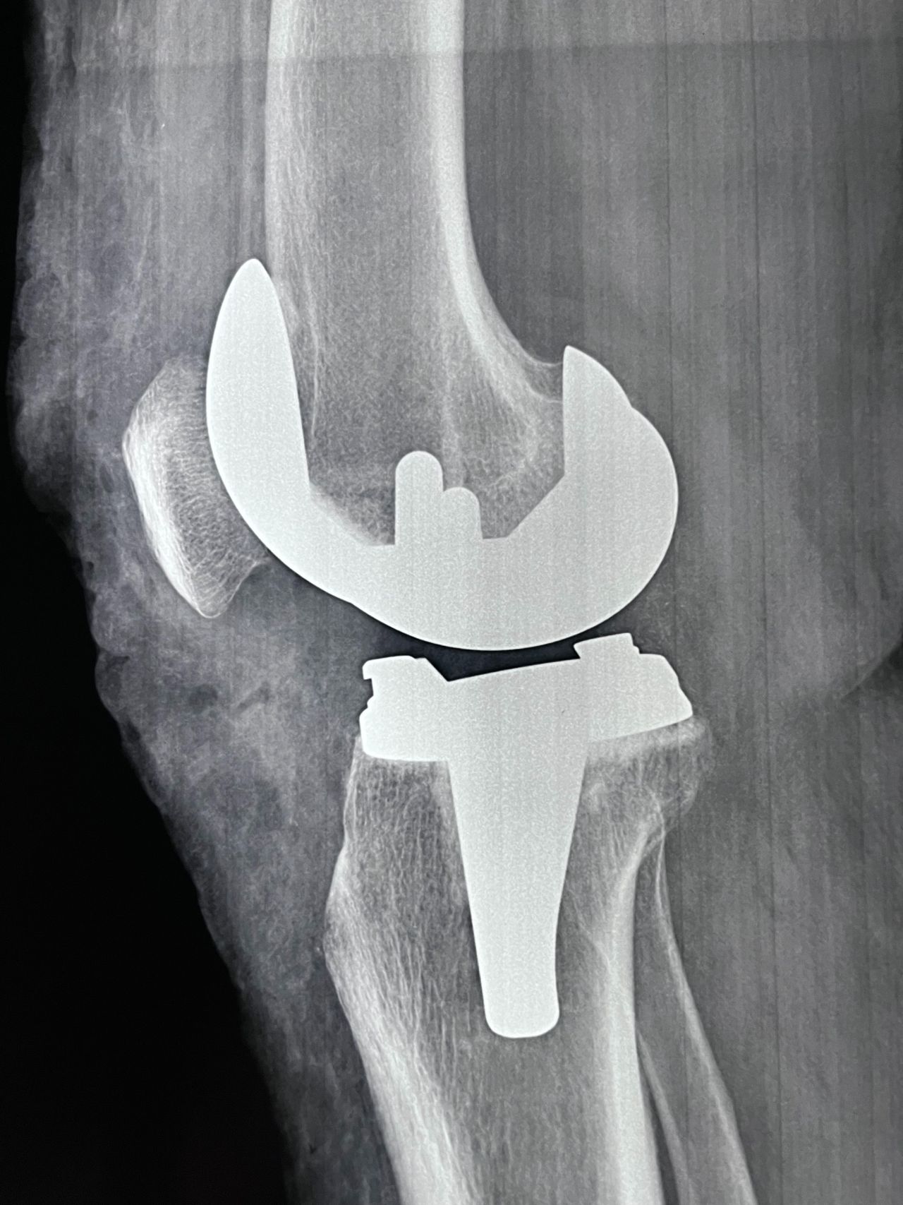 Carlos Alberto Lázaro Cubría-10
