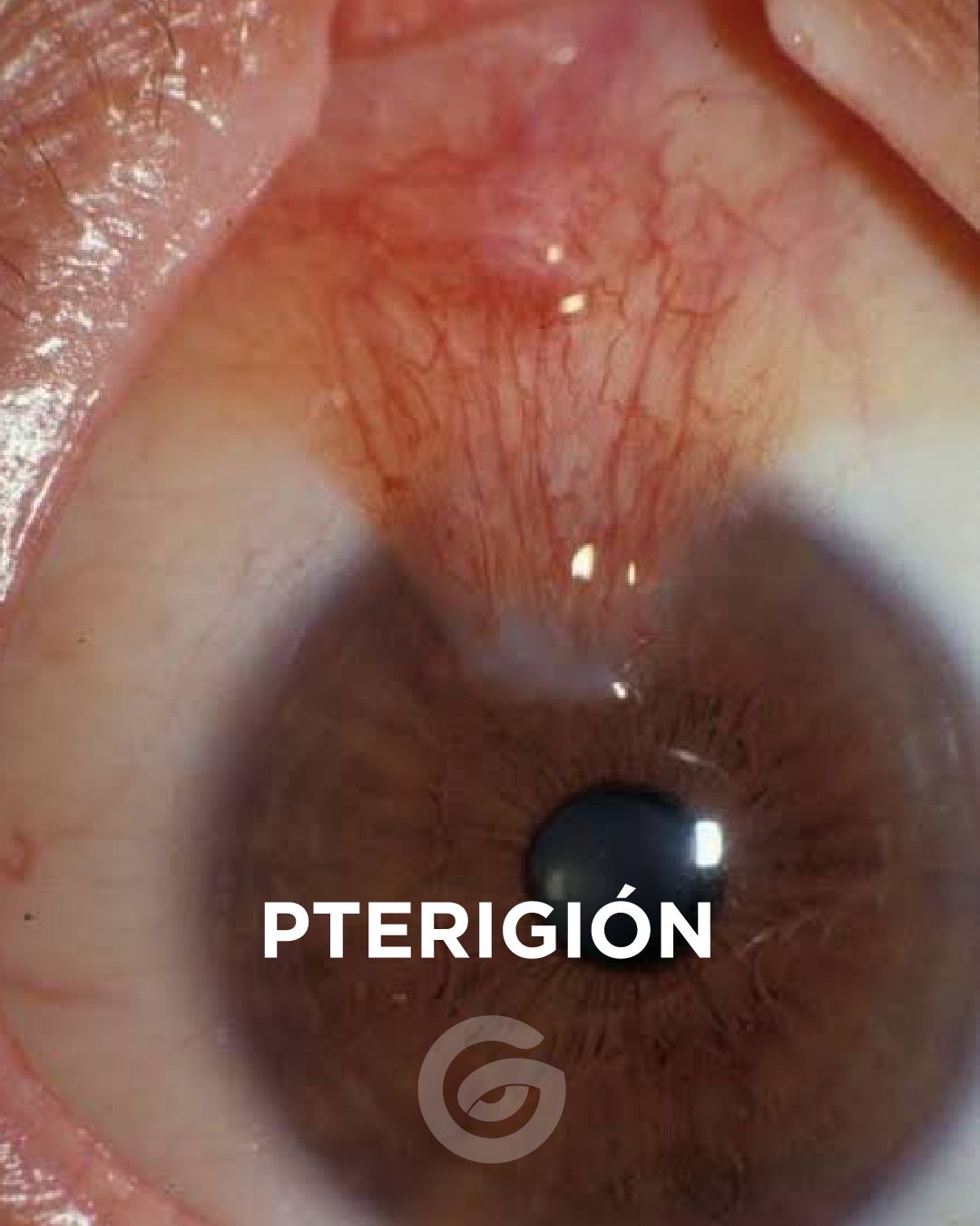 Oscar Gibran Lopez Sanchez-7