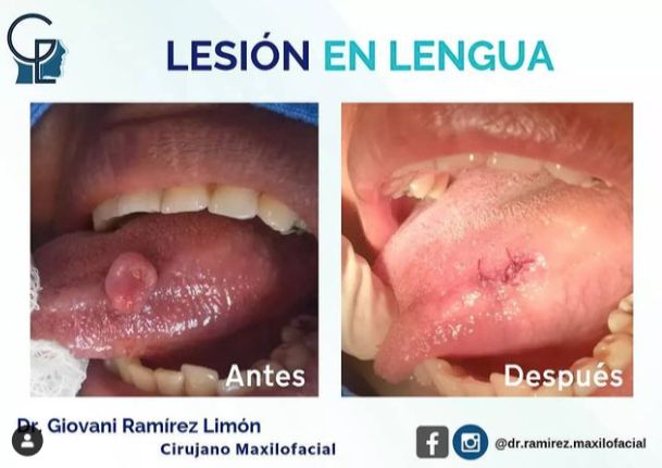 Giovani Ramírez Limón-39