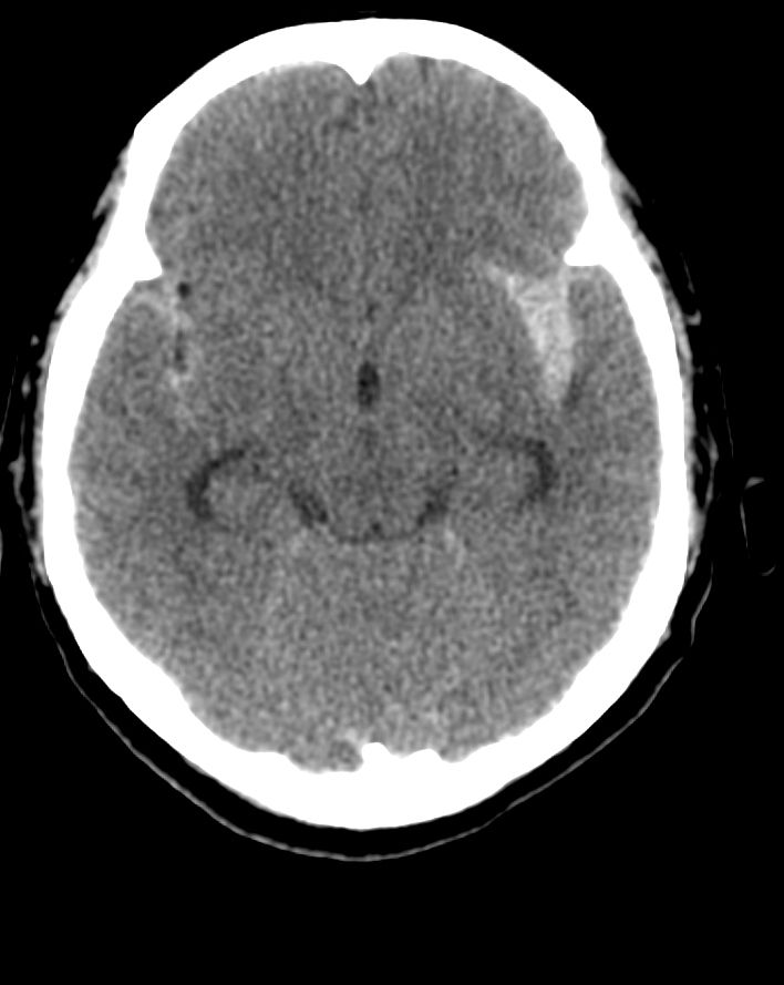 Alejandro Serrano Rubio-15