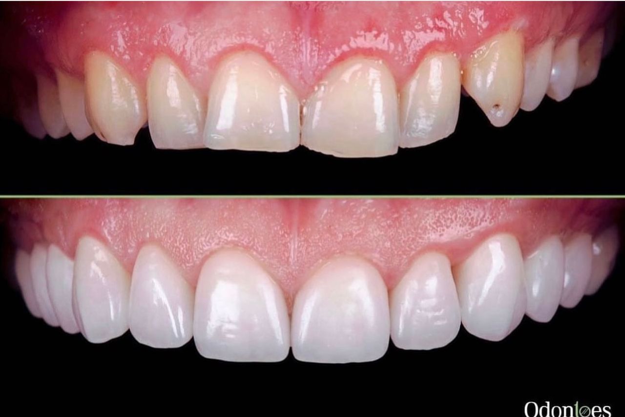 Raúl Euán Salazar-8