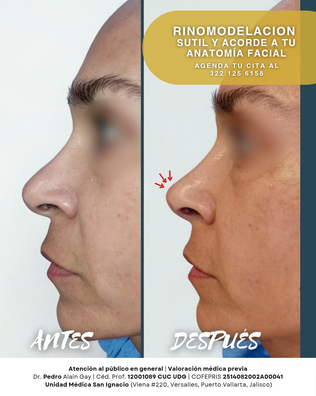 Pedro Alain  Gay Hernández -8