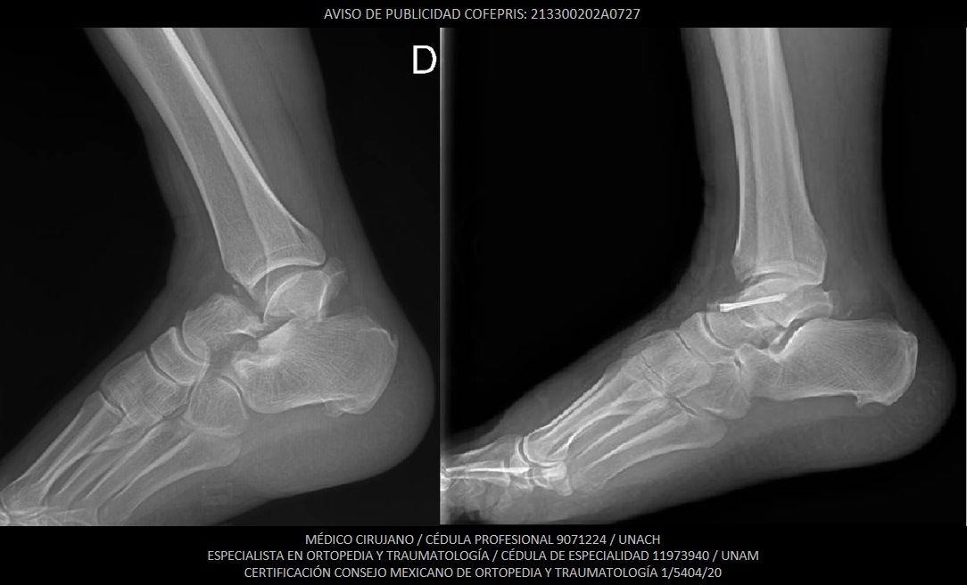 Luis Castañón Robles-13
