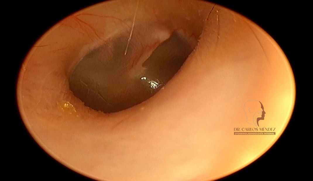 Juan Carlos Mendez Gutierrez-33