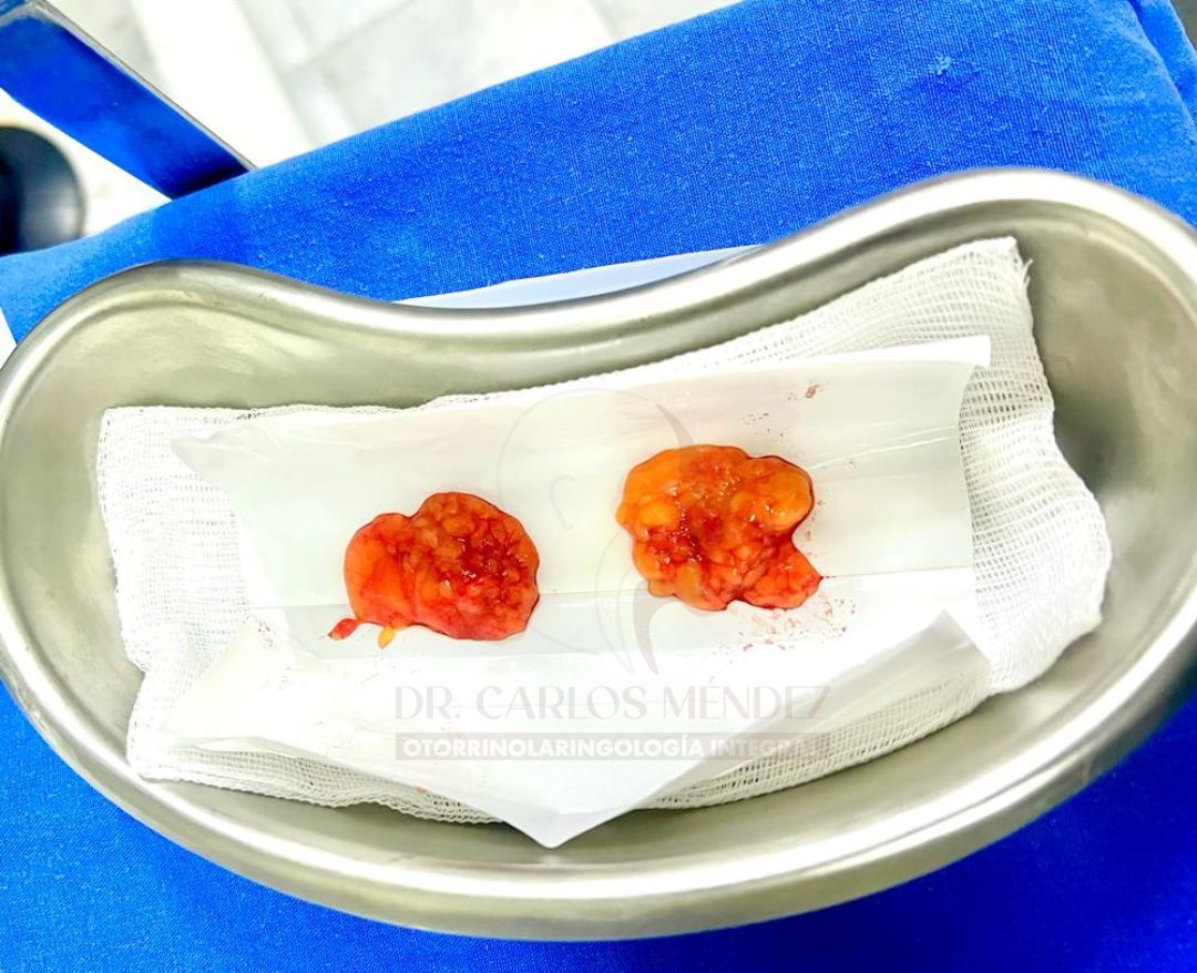 Juan Carlos Mendez Gutierrez-31