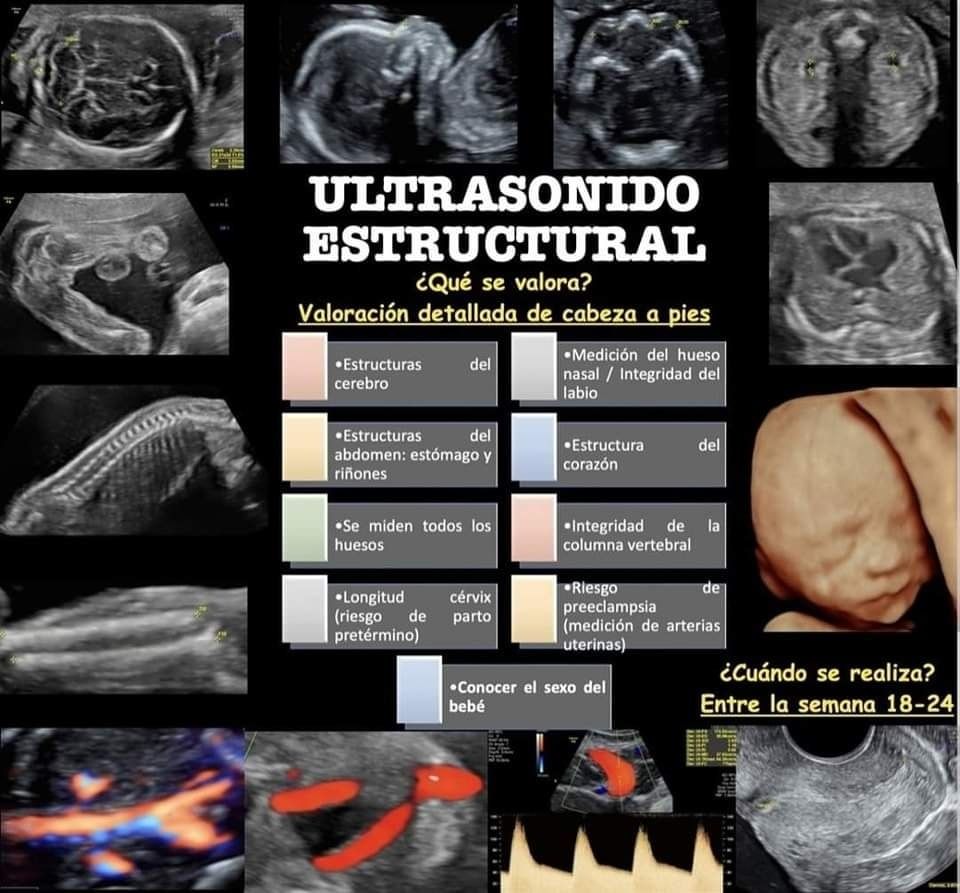 Mireya Ovando Tapia-6