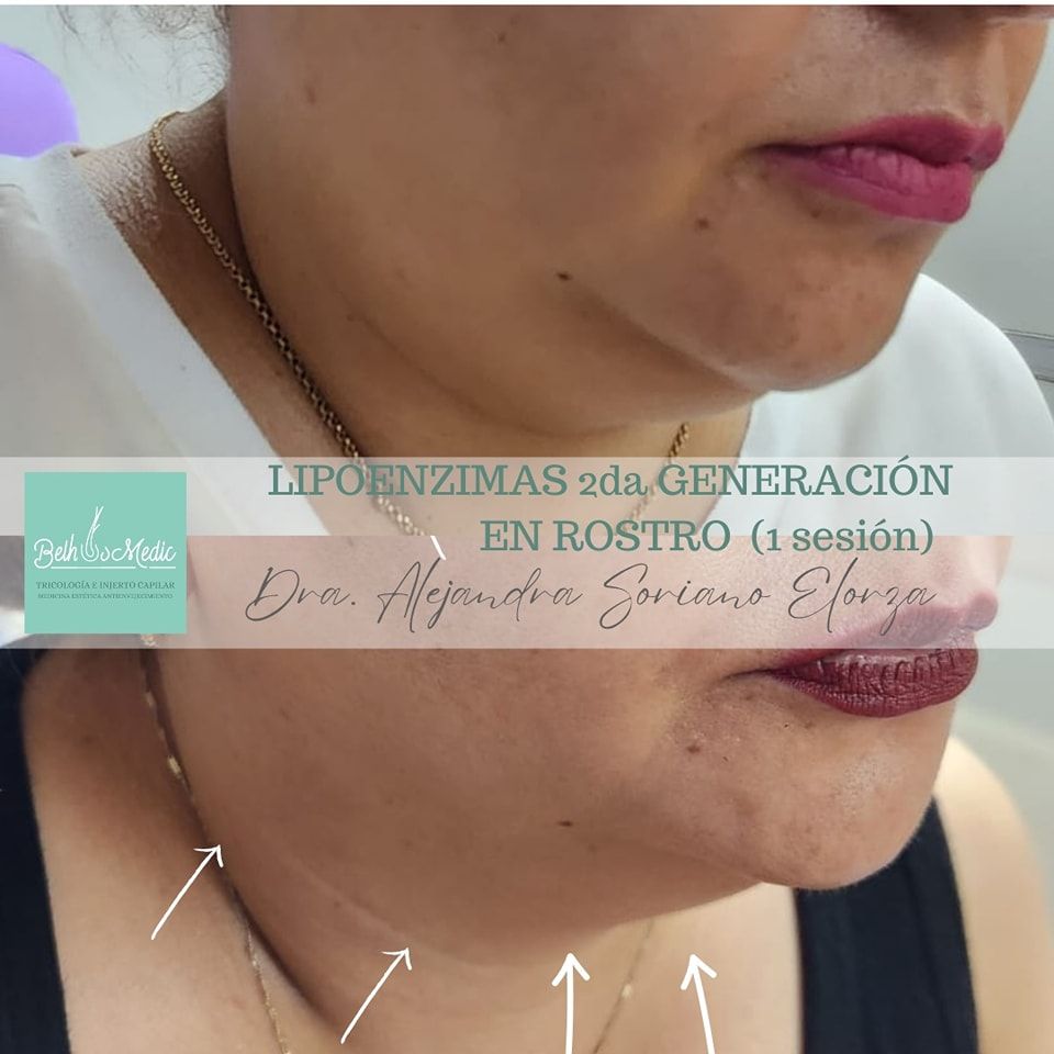 Alejandra Soriano Elorza-57