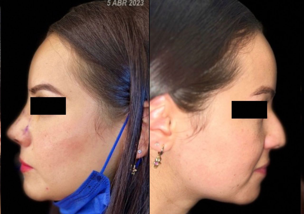 Alvaro Takane Kimura-2