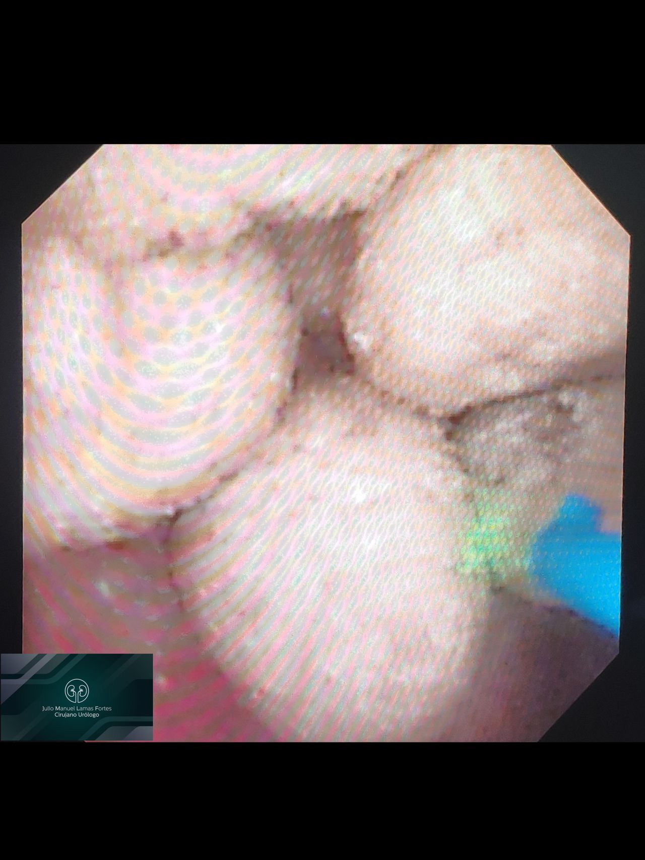 Julio Manuel Lamas Fortes-14