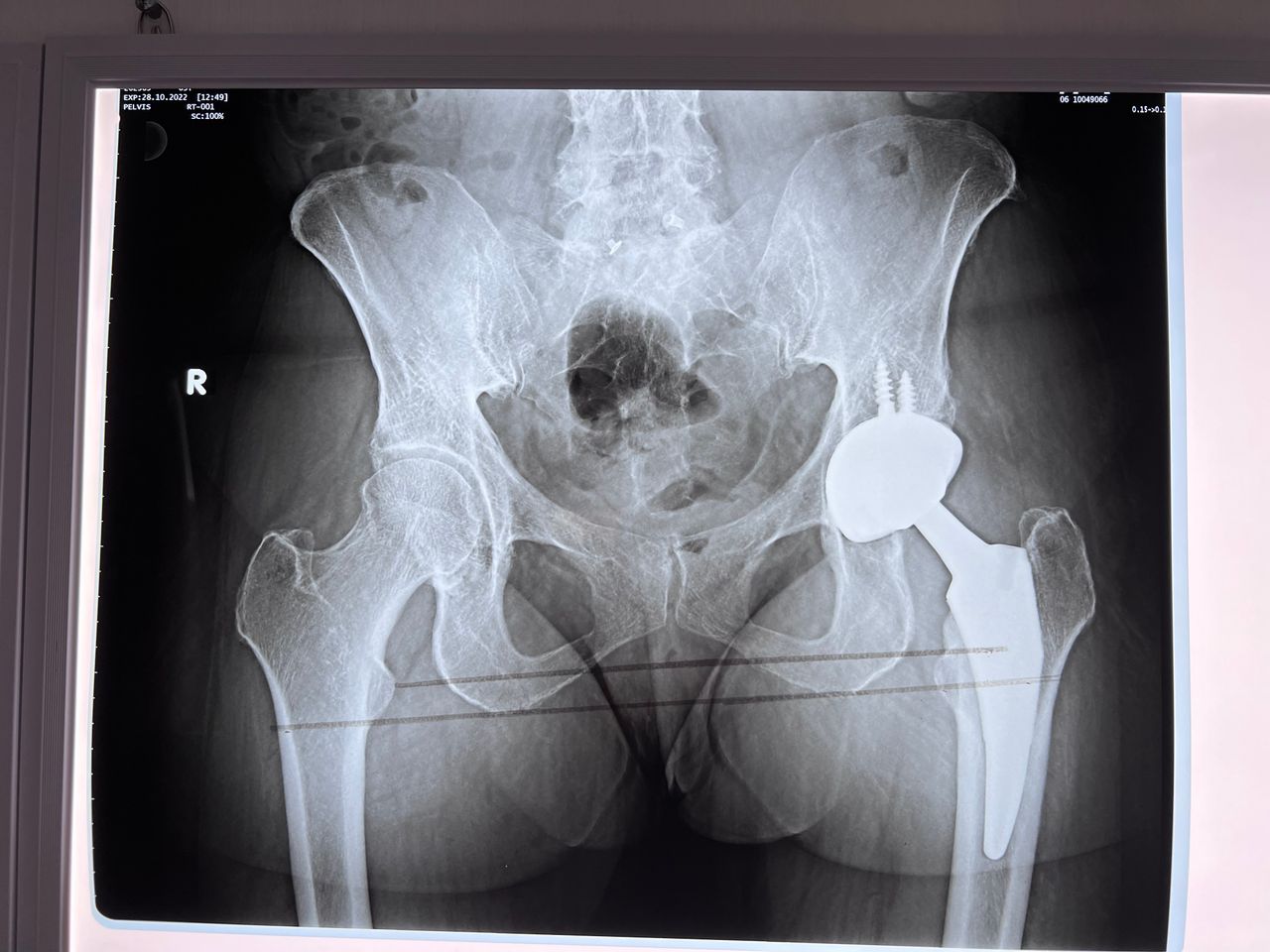 Avelino Aguilar Merlo-2