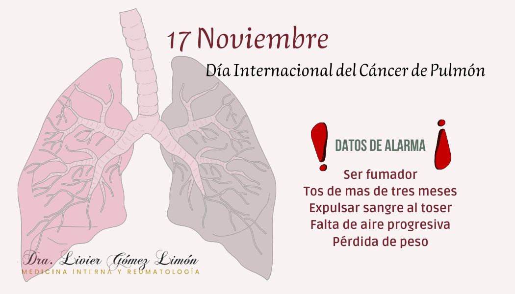 Livier Gómez Limón-14