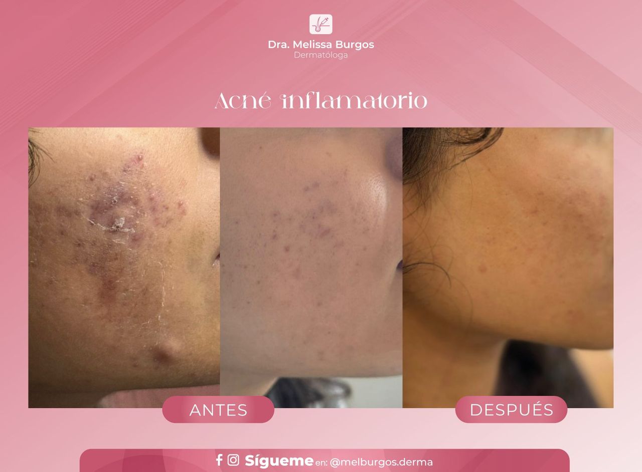 Melissa Burgos Romero-12