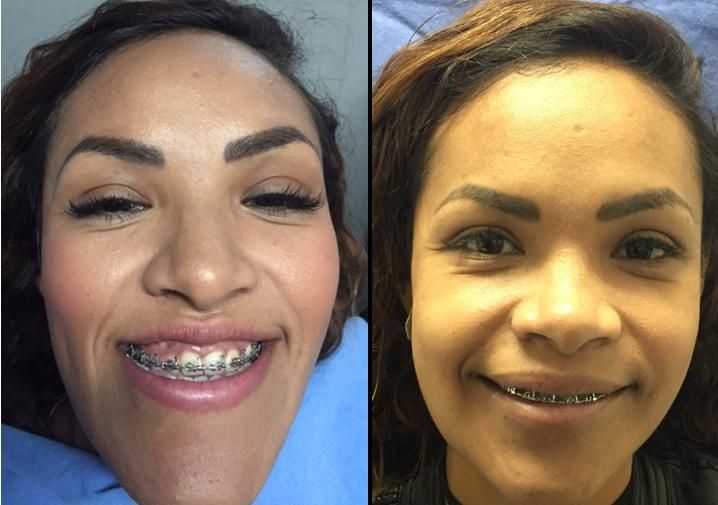 Alberto Wintergerst Fisch-34