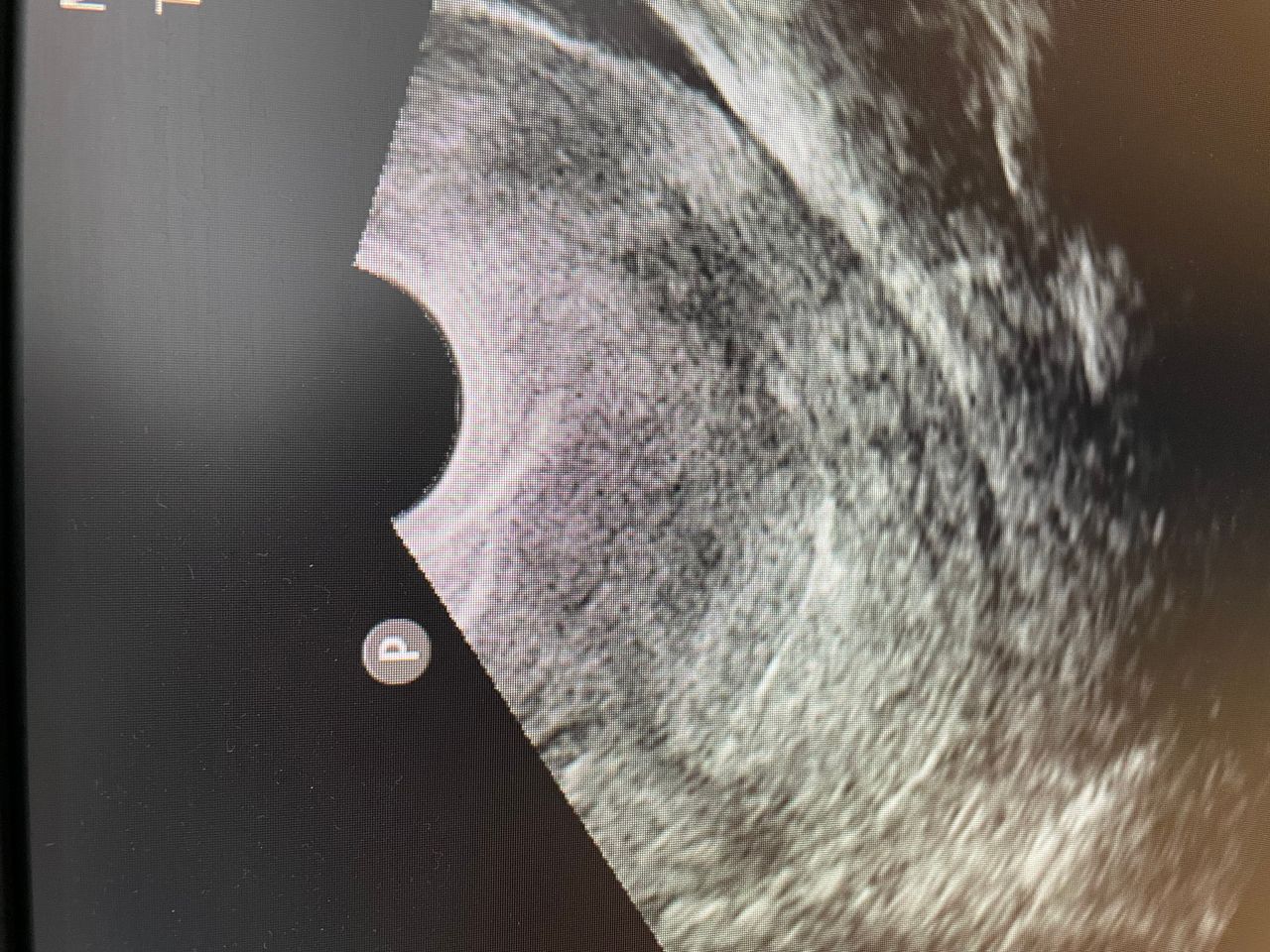 Gonzalo Hernández Martínez-34