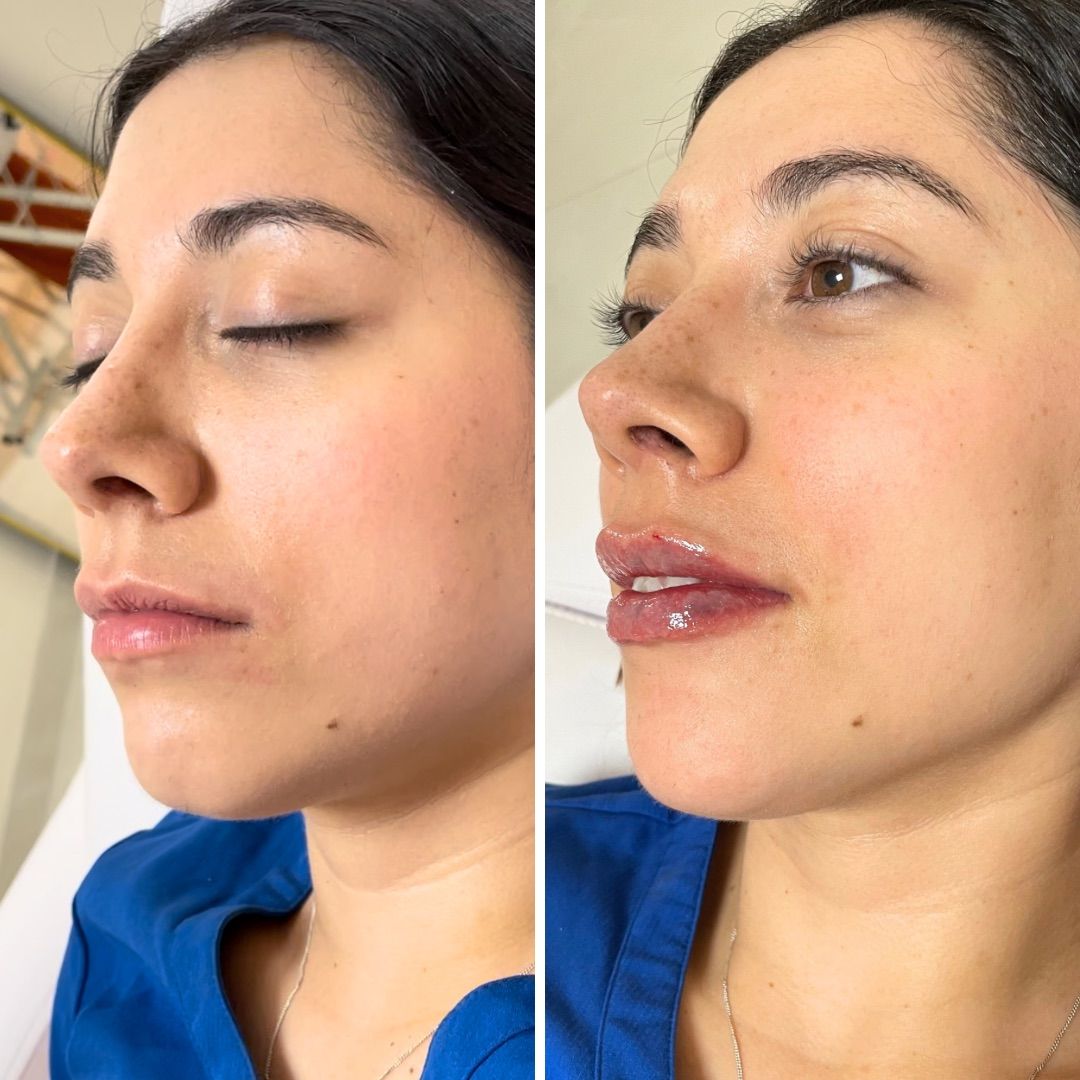 Alejandra Gutierrez García-6