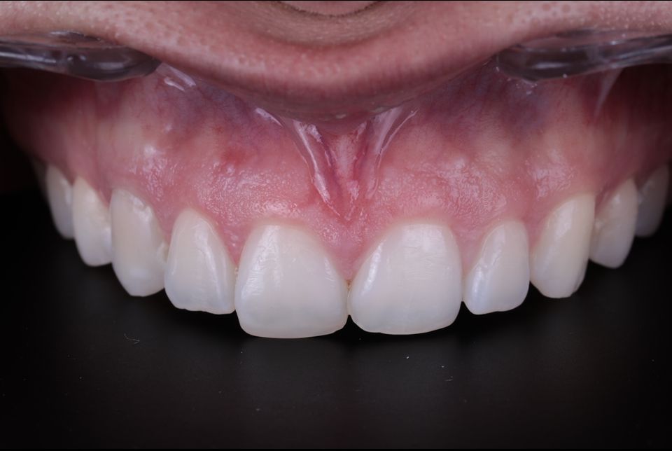 Carlos Enrique Hernández Rodríguez-4