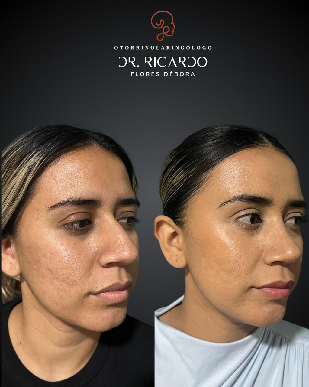 Ricardo Flores Débora-19