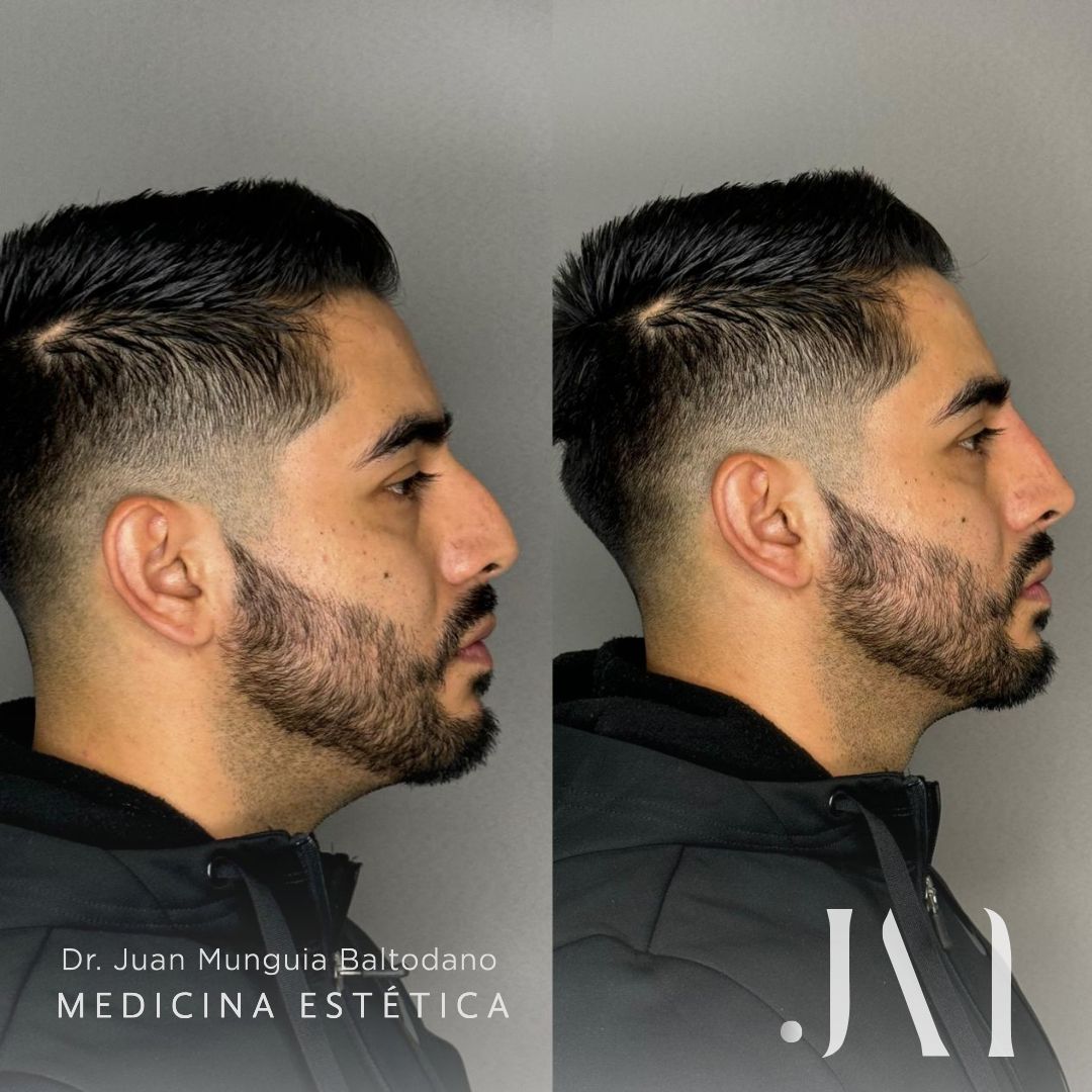 Juan Antonio Munguia Baltodano-11