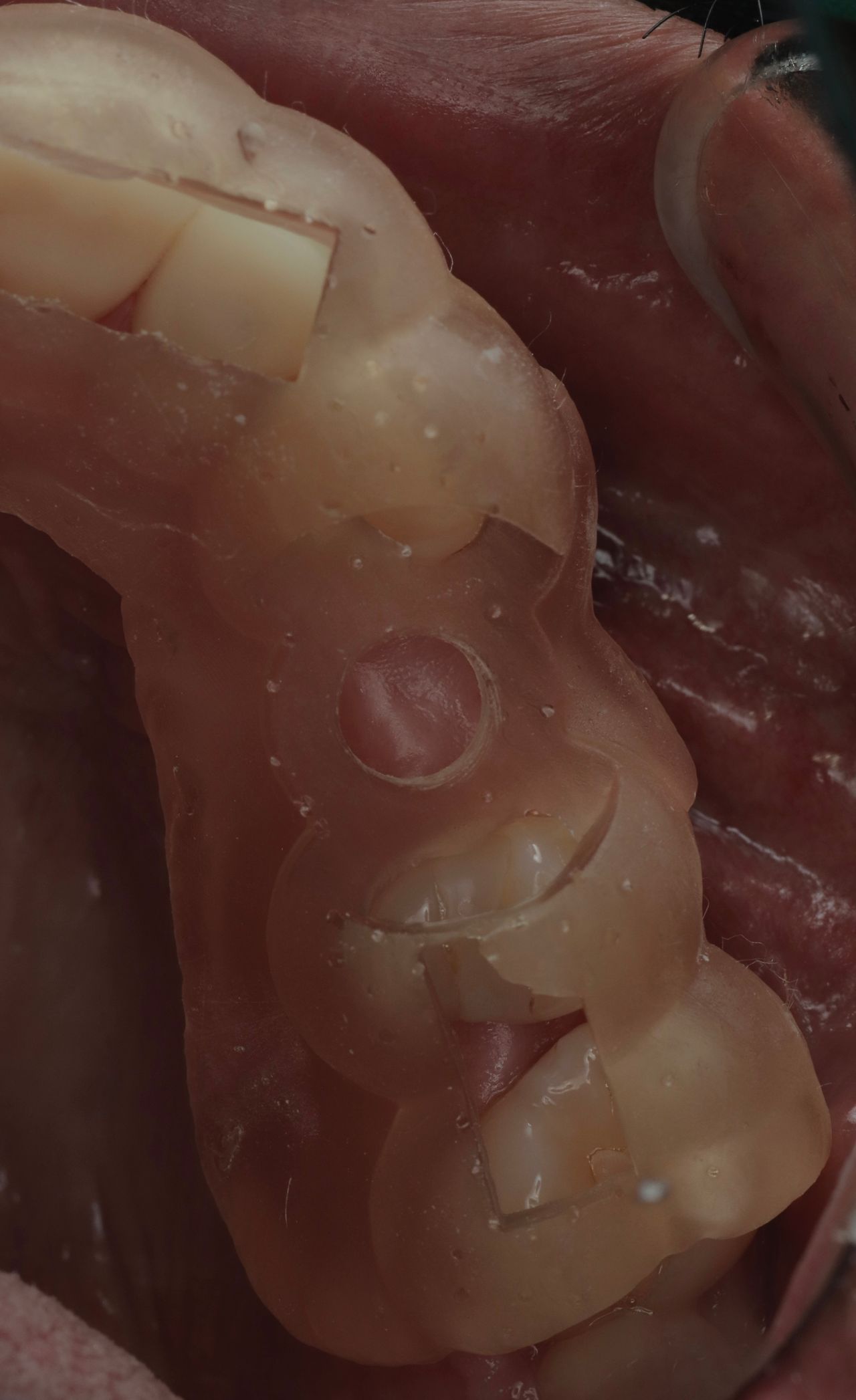 Marco Tulio Alzaga Vega-4