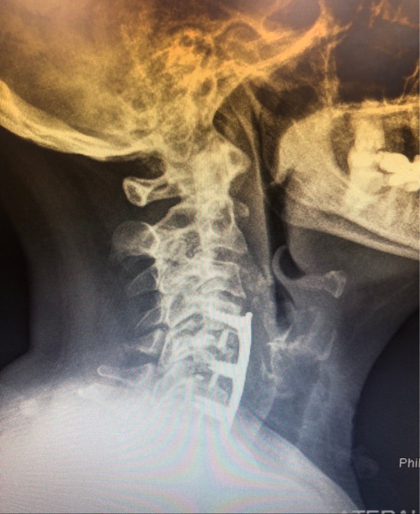 Gisela Cleto Zepeda-118