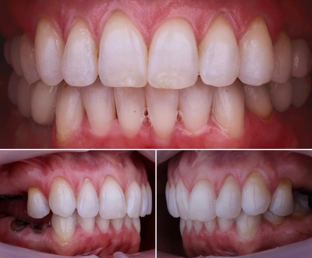 Josué Márquez Gómez-36