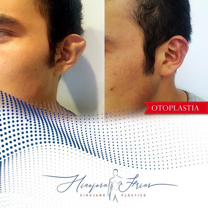 Miguel Ángel Hinojosa Frías-5