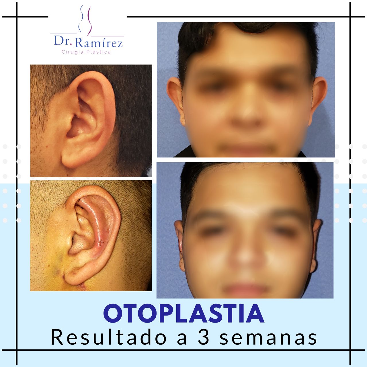 Edgar Ramírez López-69