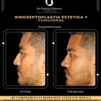 Enrique Serrano Cruz-23