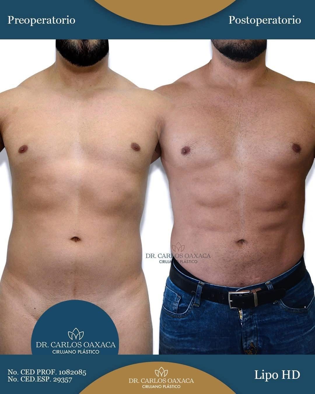 Carlos Guillermo Oaxaca Escobar-2