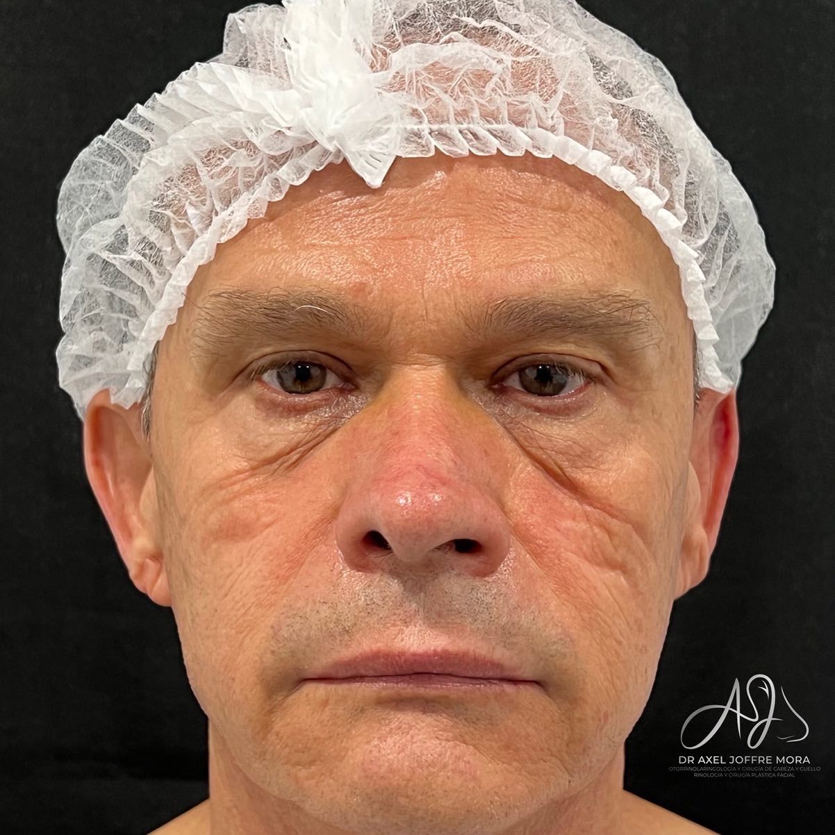 Axel Joffre Mora-184