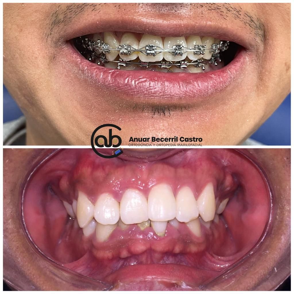 Anuar Becerril Castro-31