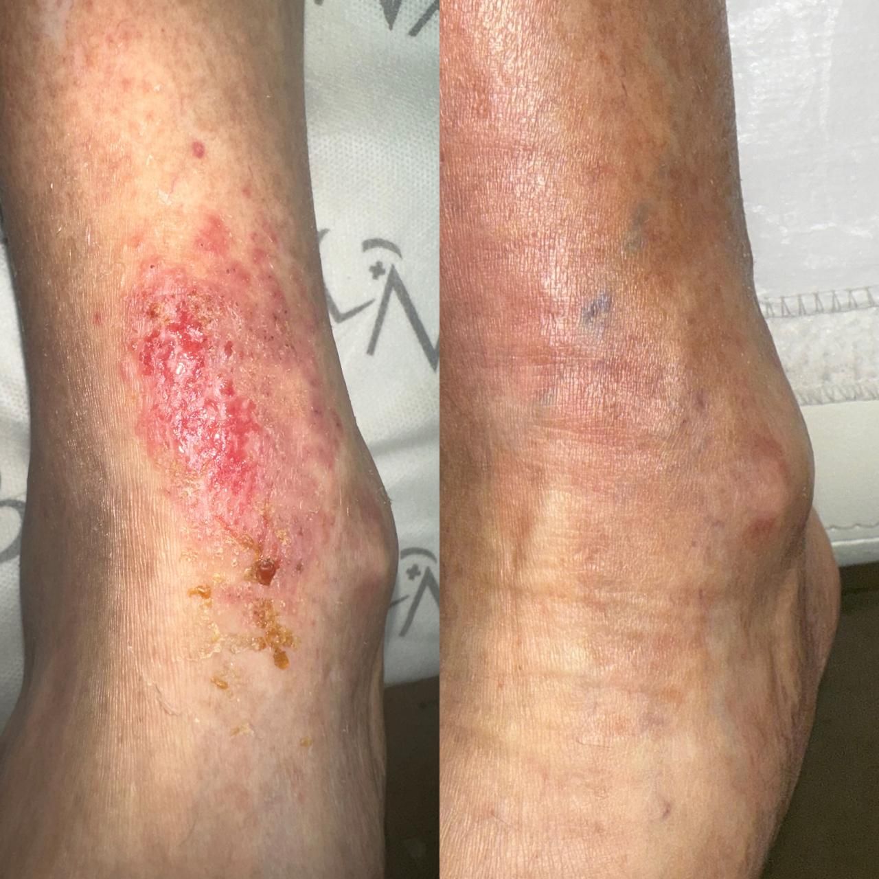 Jhonatan López González-14