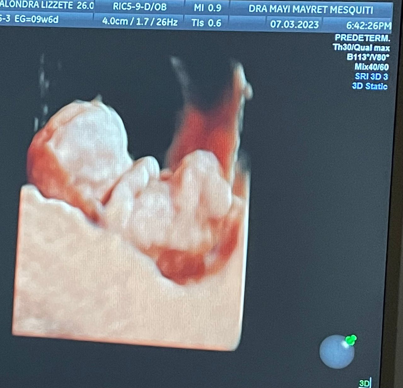 Mayi Mayret Mesquiti-16