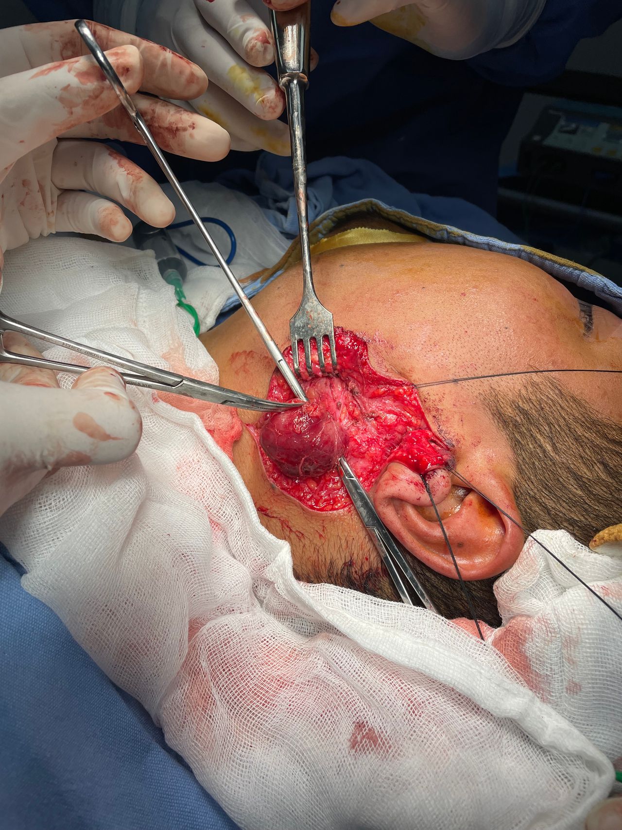 Martin Alberto Hernandez Cardenas-16